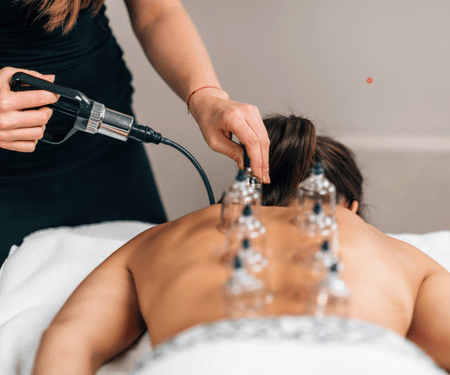 Cupping Therapy